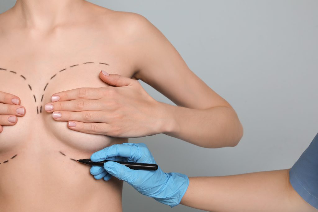 breast augmentation faq