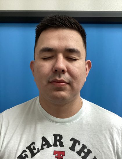 Jawline/Neck - For Men Before & After Patient #15577