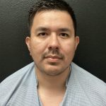 Jawline/Neck - For Men Before & After Patient #15577