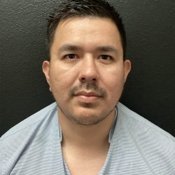 Jawline/Neck - For Men Before & After Patient #15577