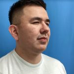 Jawline/Neck - For Men Before & After Patient #15577