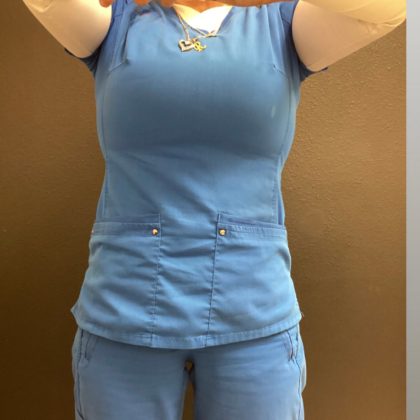 Weight Loss Before & After Patient #15829
