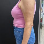 Weight Loss Before & After Patient #15901