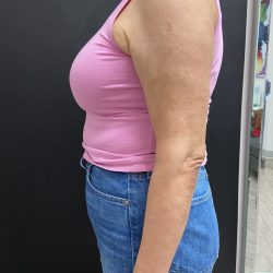 Weight Loss Before & After Patient #15901