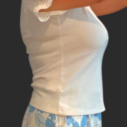 Weight Loss Before & After Patient #16311