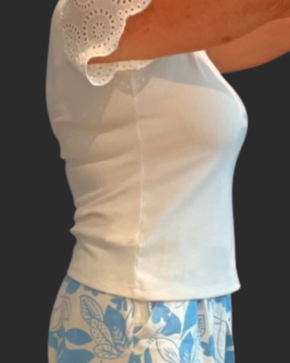 Weight Loss Before & After Patient #16311