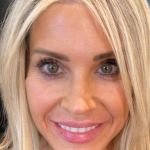 Sculptra Before & After Patient #16684
