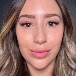 Microneedling Before & After Patient #16686