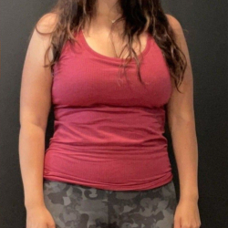 Weight Loss Before & After Patient #16940