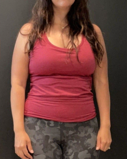 Weight Loss Before & After Patient #16940