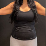 Weight Loss Before & After Patient #16940