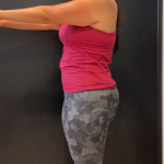 Weight Loss Before & After Patient #16940