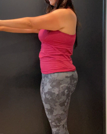 Weight Loss Before & After Patient #16940