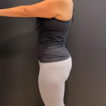 Weight Loss Before & After Patient #16940