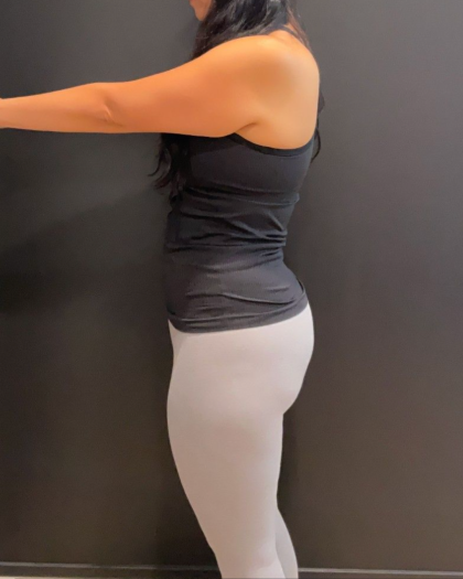 Weight Loss Before & After Patient #16940