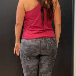 Weight Loss Before & After Patient #16940