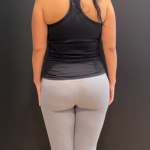 Weight Loss Before & After Patient #16940